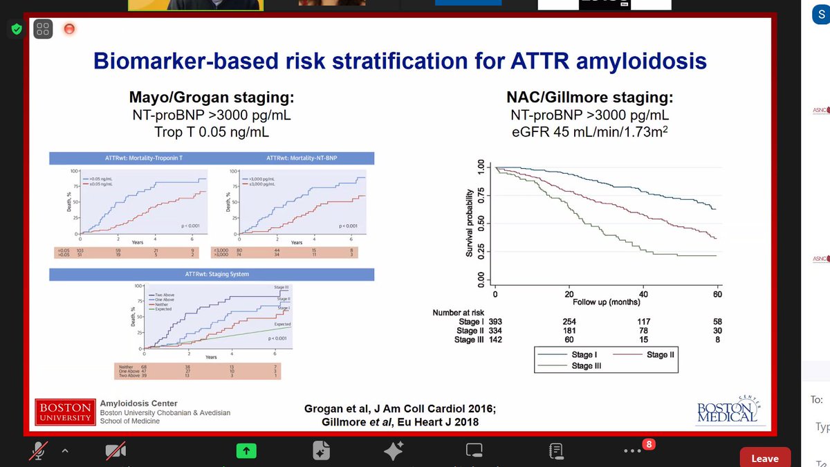 estelais's tweet photo. 💙Masterclass in Cardiac #Amyloidosis @MyASNC @NotNoninvasive @LPhillipsMD
Day 1⃣⭐️ Prognostic markers in amyloidosis by Andrew Staron @a_staron @BU_Amyloidosis
👉ATTR https://t.co/G3DTncQwwG