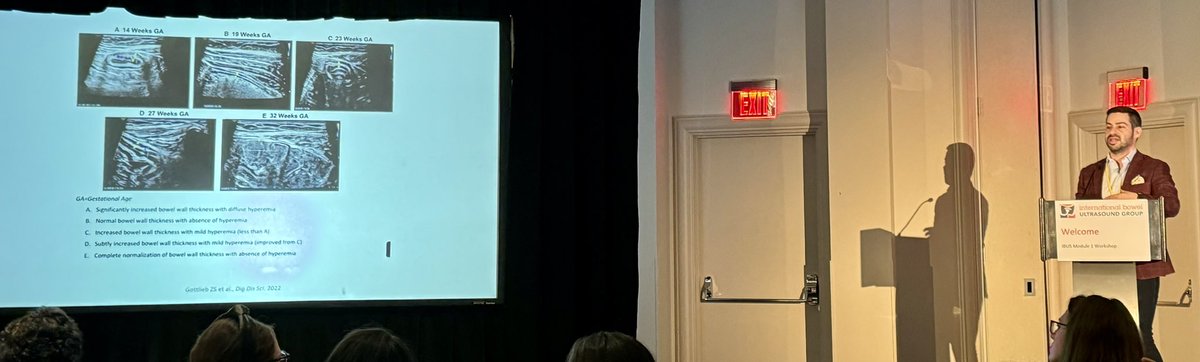 Sean Fine (@finemdisso) on Twitter photo Dr. Dolinger giving us a talk on how we can provide “next level of care” for pregnant pts with IBD using IUS
<a href="/DrMikeDolinger/">Michael Todd Dolinger, MD MBA</a> Dr. Dolinger giving us a talk on how we can provide “next level of care” for pregnant pts with IBD using IUS
<a href="/DrMikeDolinger/">Michael Todd Dolinger, MD MBA</a>