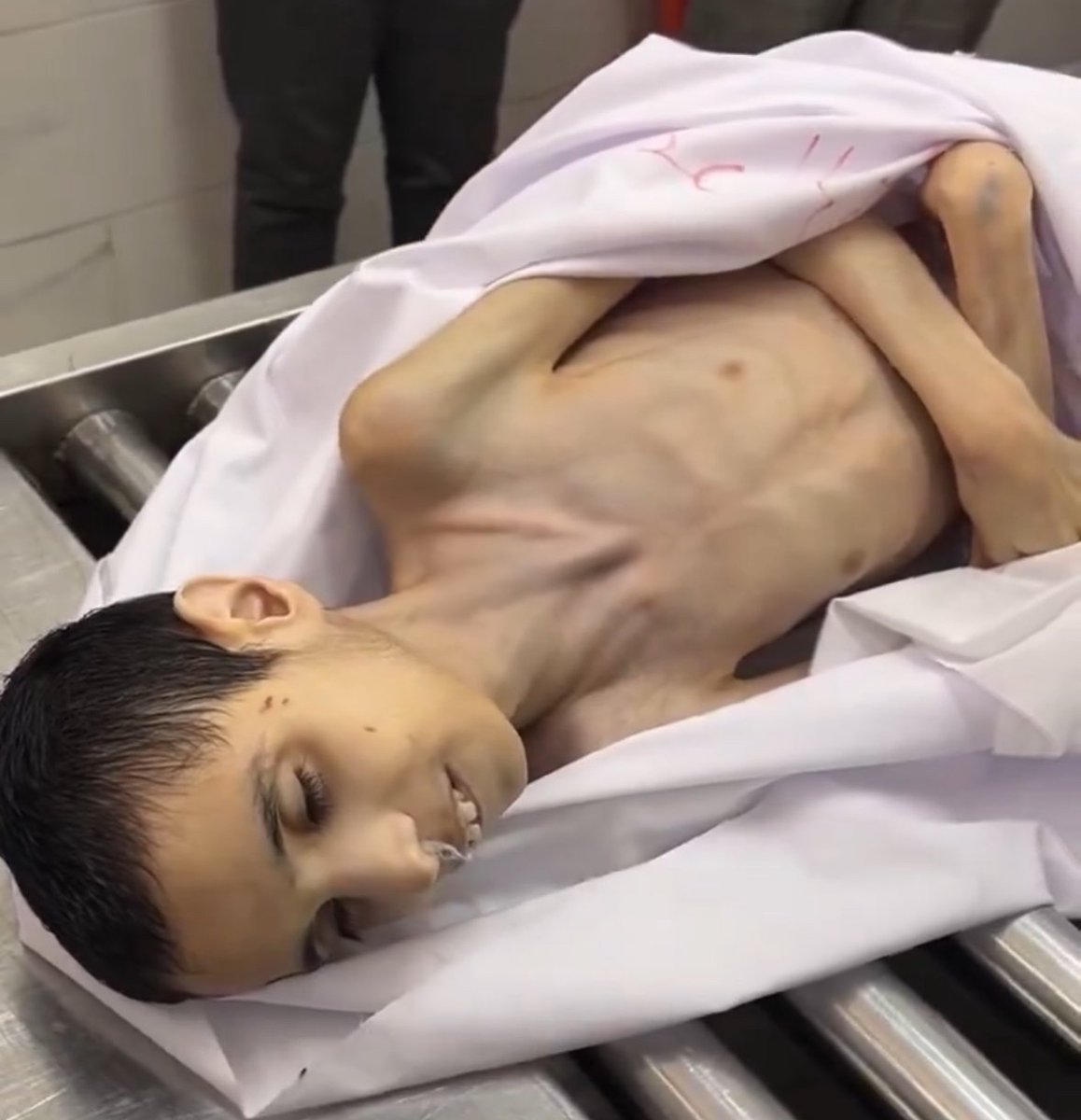 ShaykhSulaiman's tweet photo. CHILDREN ARE STARVING https://t.co/Wu4rRhugnx