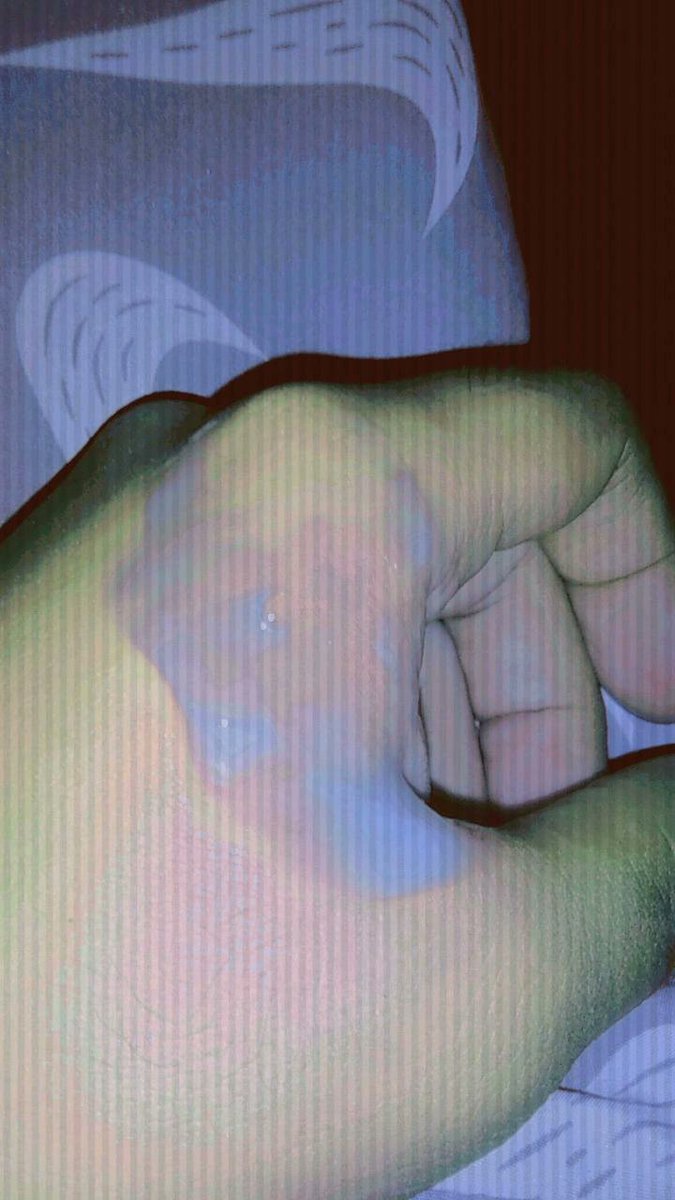 johan30289's tweet photo. Para la próxima te acabo en la boca 🥵🔥#boca #leche #uff #fire #xxx #like https://t.co/wyV2PPLR5N