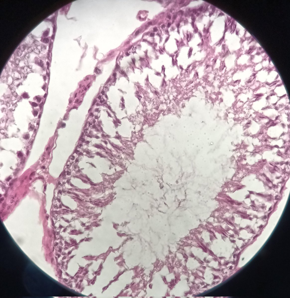 @KalaKemangga That reminds me of taking pics through microscope with phone for animal cells development practicum 2 semester ago