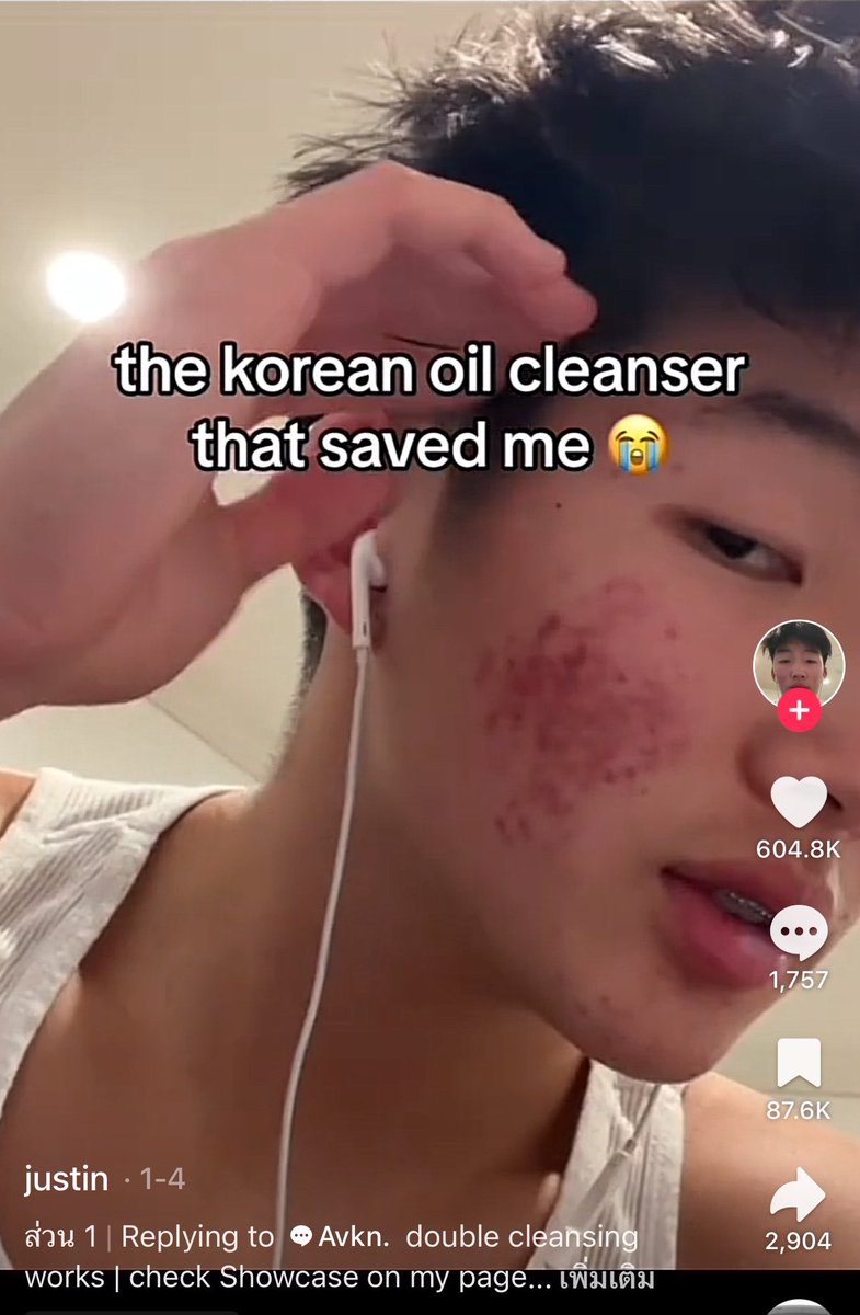 chams_girl's tweet image. อันนี้น่าลอง ￼Manyo Pure Cleansing Oil  คือคุณเค้าเป็นสิวหนักมากแล้วใช้ตัวนี้แล้วหายแต่เหมือนเค้าจะใช้ตัวอื่นร่วมด้วยแต่ตัวนี้มันช่วยเรื่องสิวเสี้ยน สิวหัวดำโดยเฉพาะเหมือนฟีลละลายหัวสิว ตำตามแล้วหนึ่งงงง