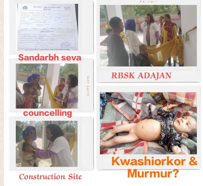 #RastriyaBalSwasthyaKaryakrm
A child with Kwashiorkor &amp; suspected murmur found at construction site. Counseling &amp;"Sandarbh Seva" given to parents &amp; sent to DEIC, Civil hospital with RBSK TEAM, ADAJAN. Surat Municipal Corp 
@GujHFWDept <a href="/NHMGujarat/">NHM Gujarat</a> <a href="/GujaratSHRBSK/">Gujarat SH (RBSK) Rashtriya Bal Swasthya Karyakram</a> <a href="/GujaratRbsk/">RBSK GUJARAT🇮🇳🇮🇳🇮🇳</a>