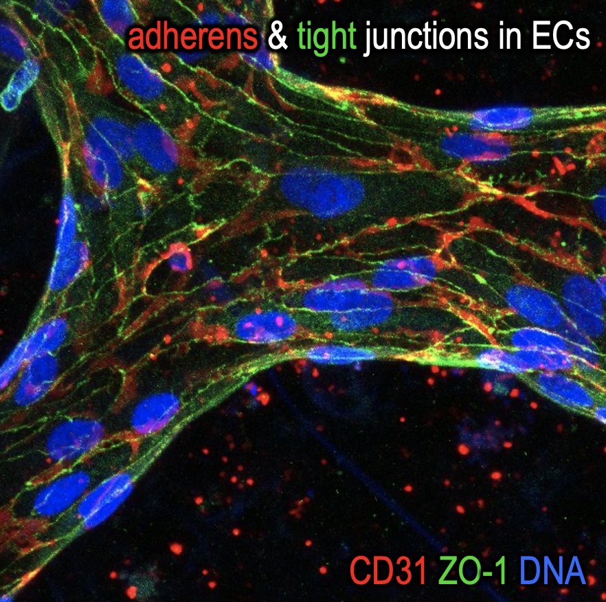 PaquetLab's tweet photo. I will present our new fully #iPSC derived model of the blood-brain-barrier to investigate neurovascular diseases. Check it out at #ADPD2024 today! https://t.co/OlJnGblfPT