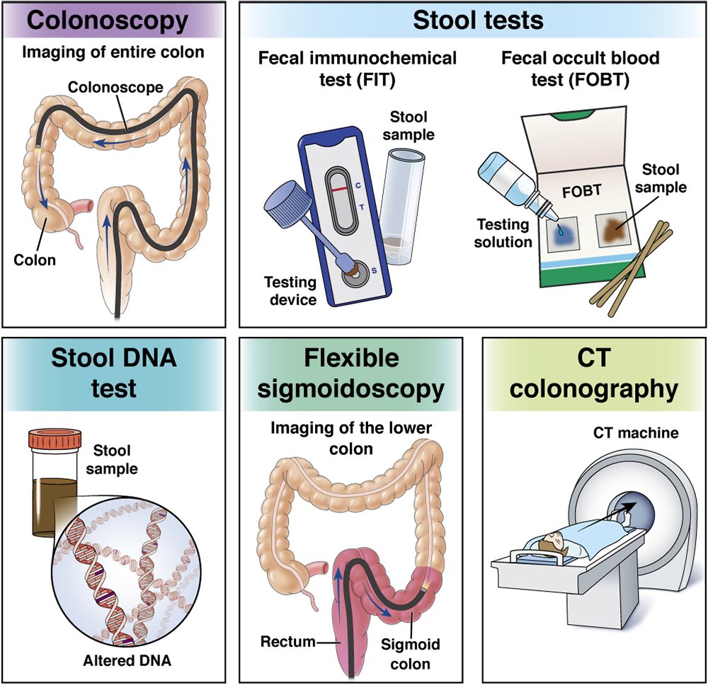 Keith Siau (@drkeithsiau) on Twitter photo Methods of colorectal cancer screening #ColorectalCancerAwarenessMonth
(via <a href="/AmerGastroAssn/">American Gastroenterological Association (AGA)</a>) Methods of colorectal cancer screening #ColorectalCancerAwarenessMonth
(via <a href="/AmerGastroAssn/">American Gastroenterological Association (AGA)</a>)