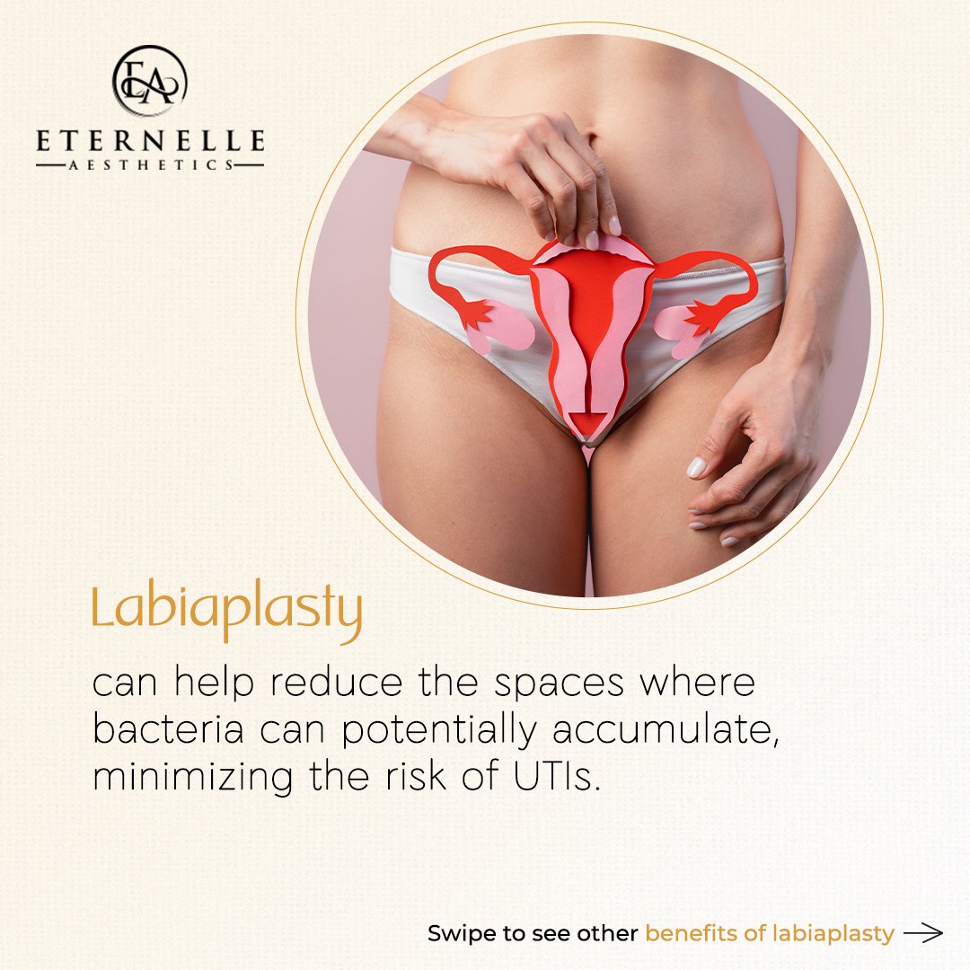 Eternelle_'s tweet photo. Labiaplasty is a cosmetic surgery to reshape the labia for aesthetic and comfort reasons. It addresses concerns related to the size and symmetry of the labia, enhancing both appearance and quality of life for women.
#Labiaplasty #surgery  #drmaalavikaappasani #eternelleaesthetics https://t.co/nPKe7ccpSy