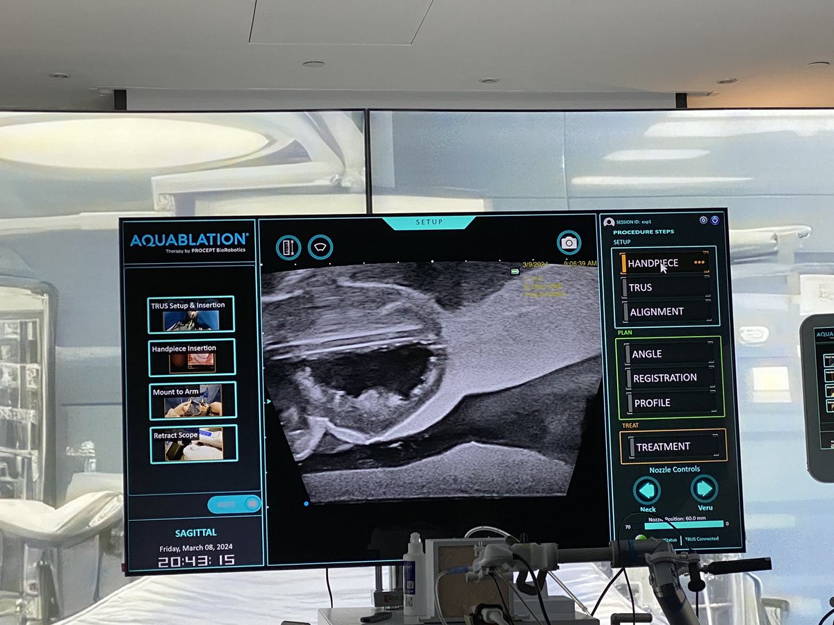 ShivPandian's tweet photo. Privilege and honour to participate in the first #AquablationTherapyforBPH Discovery meeting in London yesterday. Convinced that this is going to be #StandardOfCare in the coming years. It is suited for all sizes and shapes of #Prostates and achieves maximum efficacy with minimal / no side-effects. Huge thanks to Mr. Rick Popert @GuysUrology & Mr.Neil Barber @FrimleyHealth @PROCEPTRobotics for kindly enlightening us & providing #HandsOnExperience on the model. Looking forward to #LiveSurgery experience and setting up service @NorthMidNHS