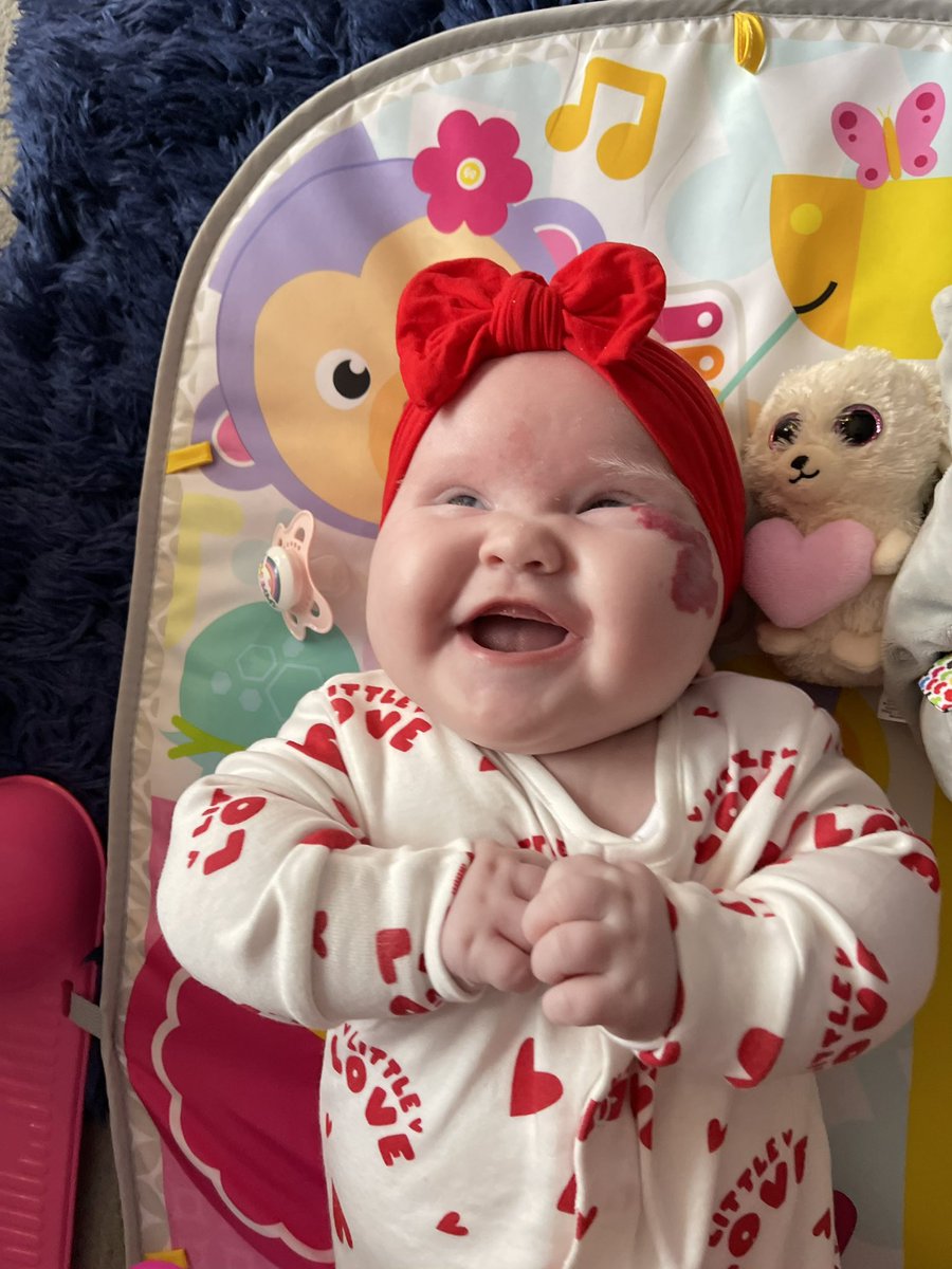 wee_bubsxox's tweet photo. Will there ever be a cheekier wee cabbage patch 🥰❤️ https://t.co/Fbw73DrfQd