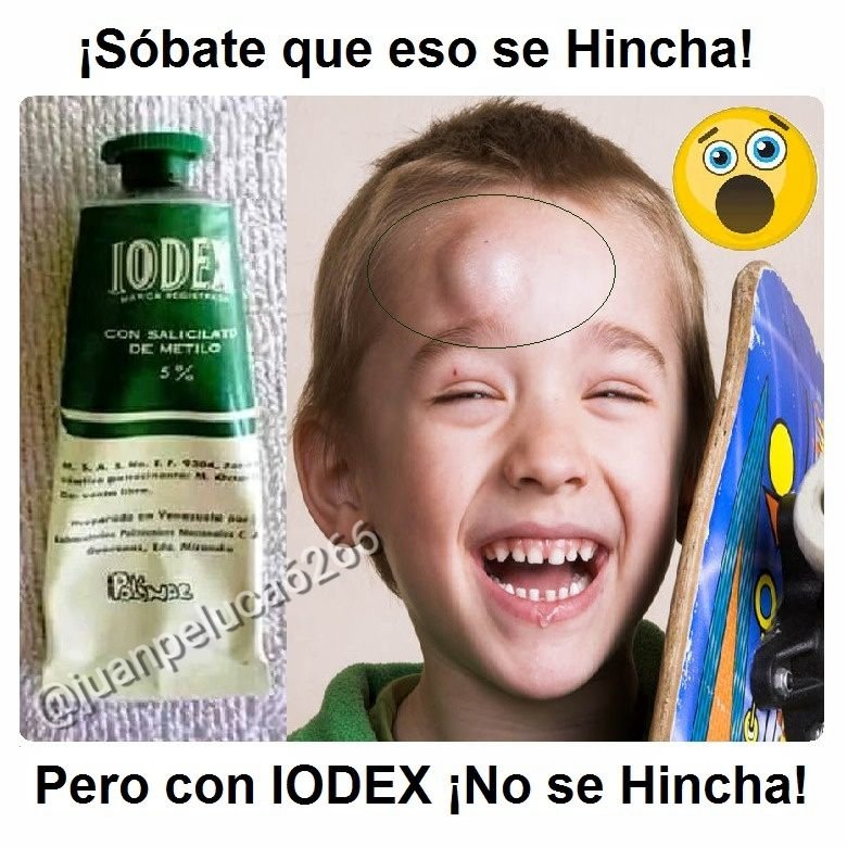 Quiénes se doblaron el tobillo y los sobaron con  IODEX ?