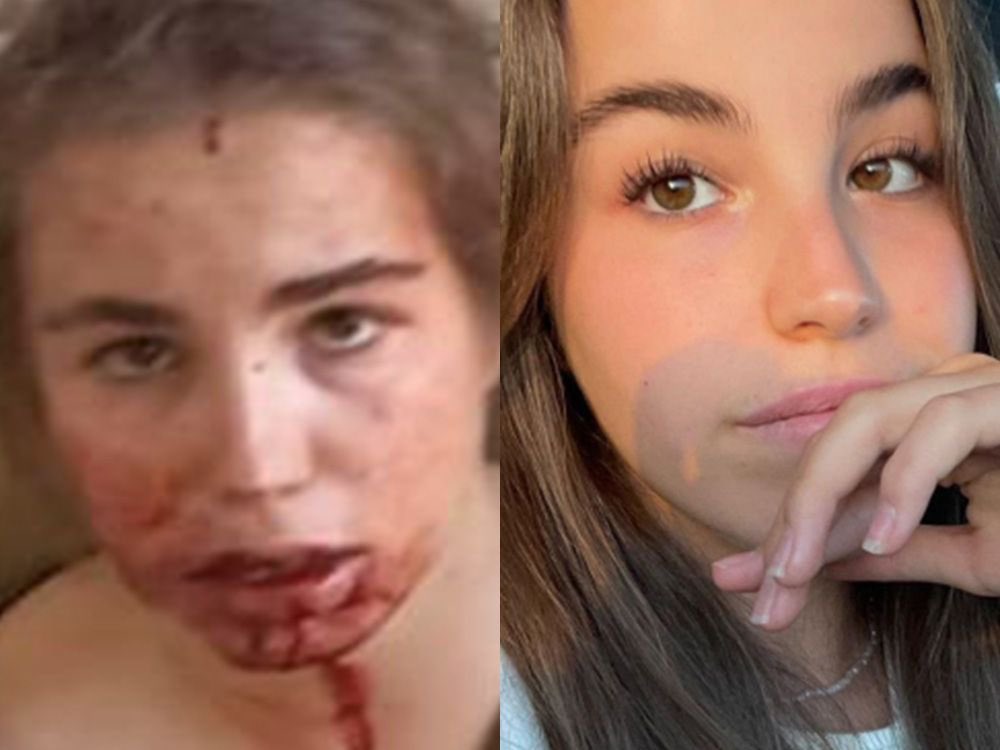 TSchwarzbard's tweet image. This is what Hamas does to Israeli women. 

If you can’t speak out against this, I don’t want to read your hypocritical and surface posts “celebrating” International Women’s Day and Women’s History Month. 

Bring our girls home.