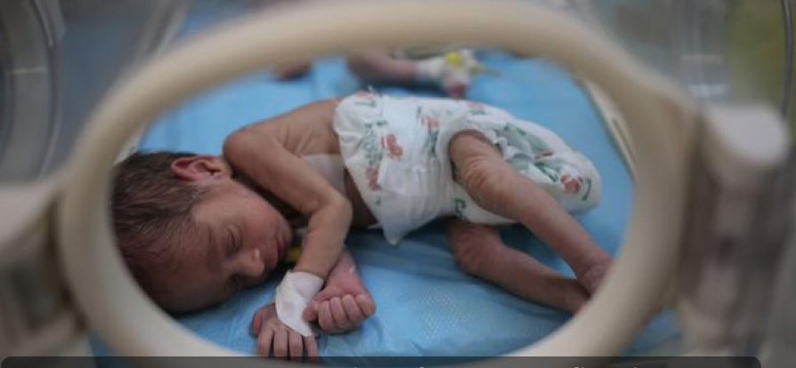mhdksafa's tweet photo. You remember when there was more global outrage about 40 fake babies than 15,000 real dead children.

15 additional babies have now died in Gaza as a result of malnutrition and dehydration.

If you are in favor of this you have lost your soul. https://t.co/irZt5R2bIj
