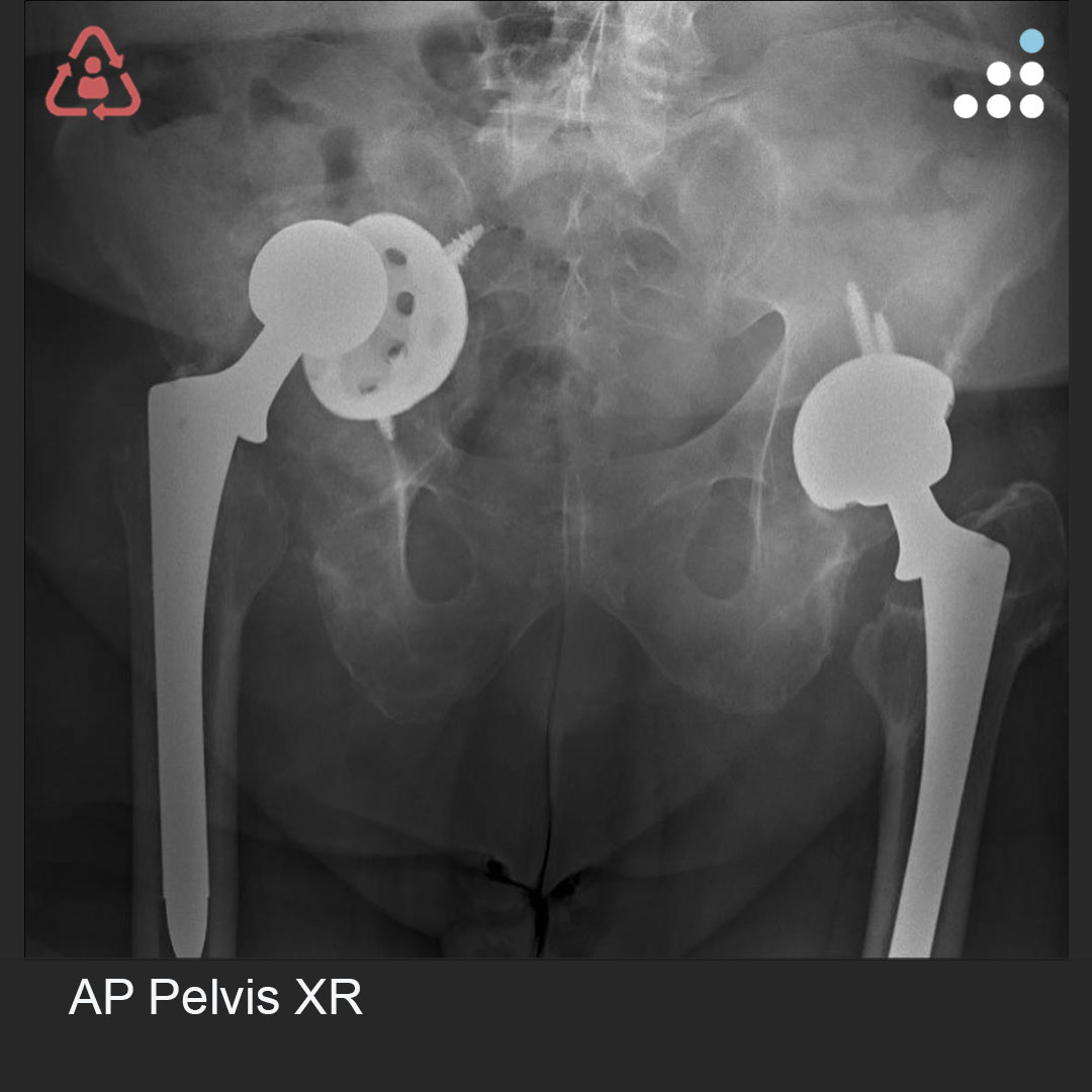 Orthobullets tweet media