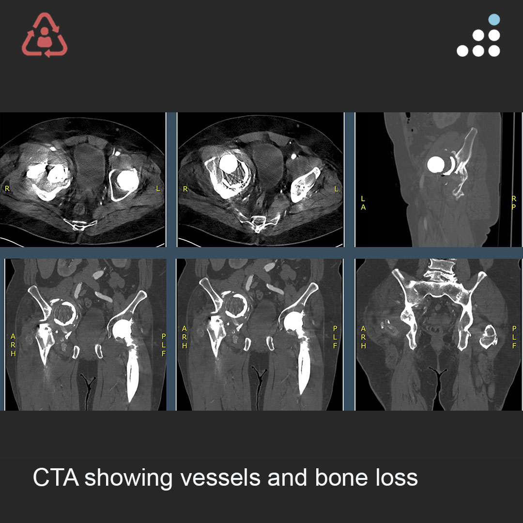 Orthobullets tweet media