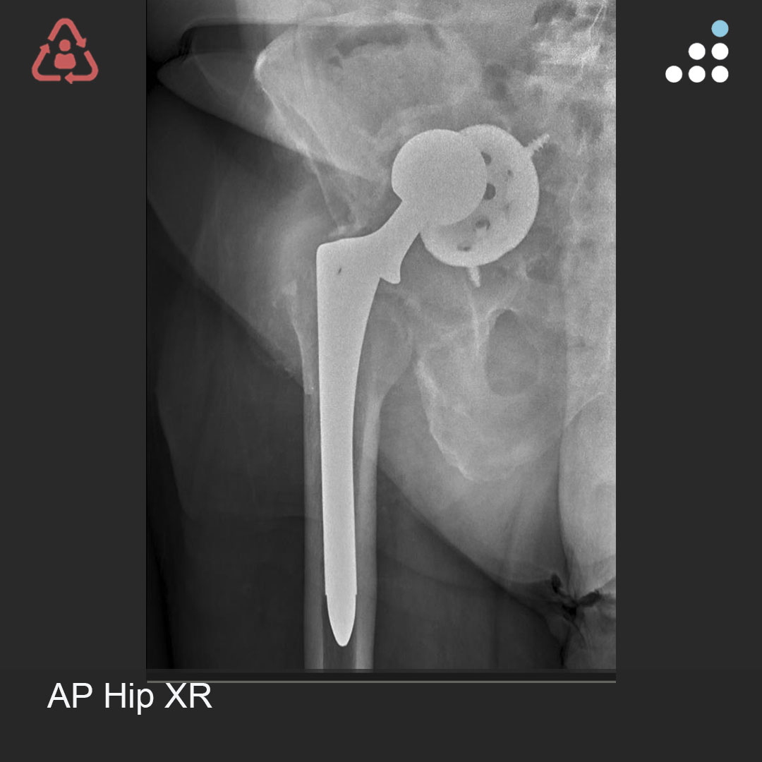 Orthobullets tweet media