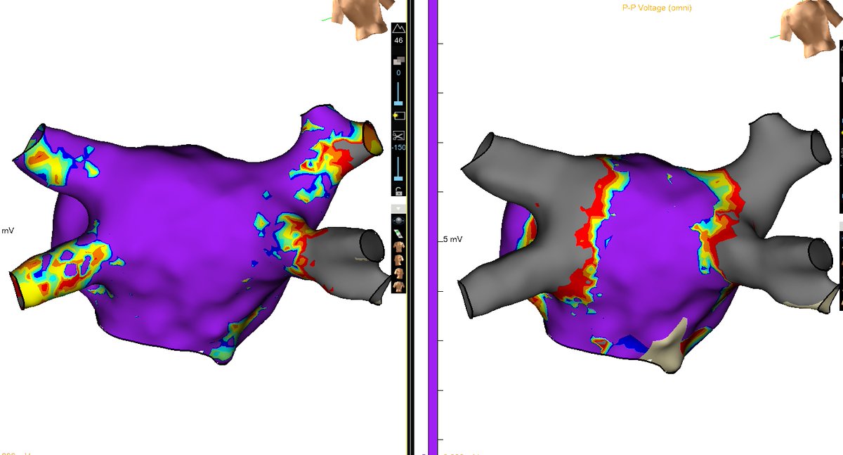 Hany Demo, MD, FACC, FHRS tweet media