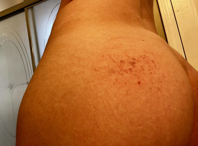 I permanently have welts and bruises on my ass and legs these days - if you&rsquo;ve been missing our live<a href="/tag/mvsales"class="tags"><span>#mvsales</span></a>