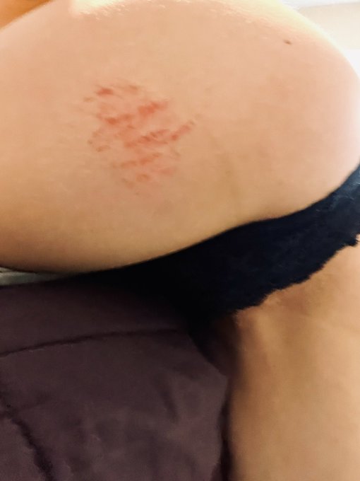 I permanently have welts and bruises on my ass and legs these days - if you&rsquo;ve been missing our live<a href="/tag/mvsales"class="tags"><span>#mvsales</span></a>