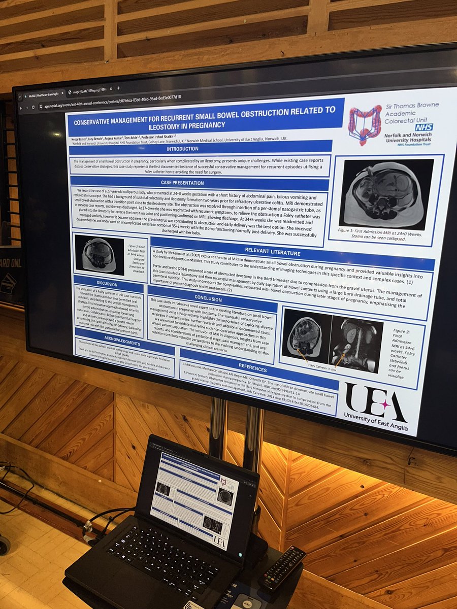 nestabaxter's tweet photo. Grateful to present our Poster today @ASiTofficial 2024 in Bournemouth. 

Thank you to Professor @ishaikh4 for your support and the opportunity to represent @ThomasBrowneACU @NNUH.

Finally thank you to my co-authors and friends! Looking forward to further work on this topic. https://t.co/tB6I0Wv2LM