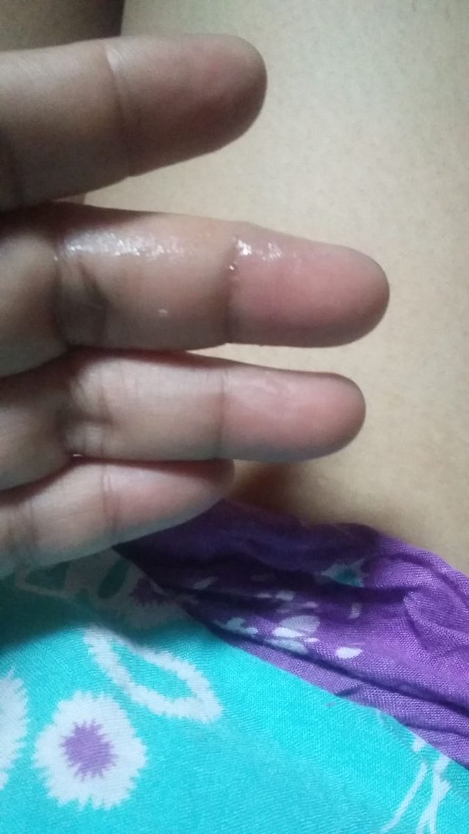 Tidak1780's tweet photo. Becek  jadi pengen hheee https://t.co/KsXMkxTxxw