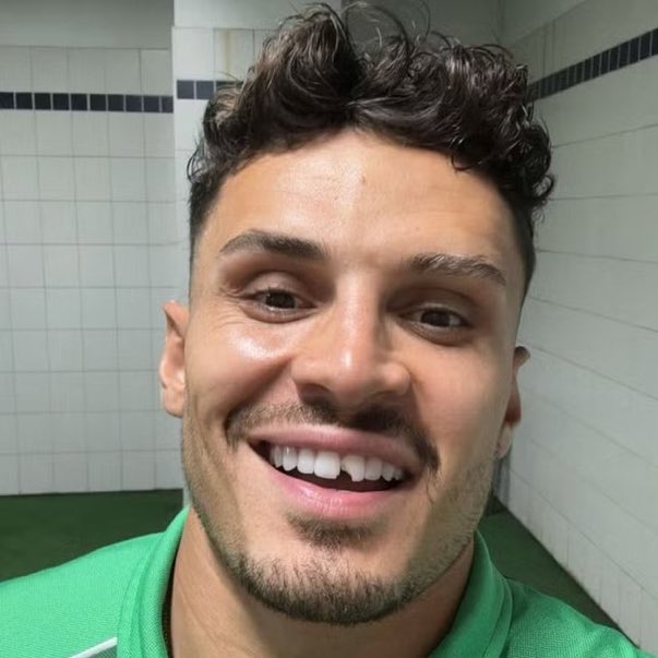 LinecBuild's tweet image. Raphael Veiga quebrou o dente no jogo do Palmeiras contra o Botafogo-SP.
📸 Reprodução.