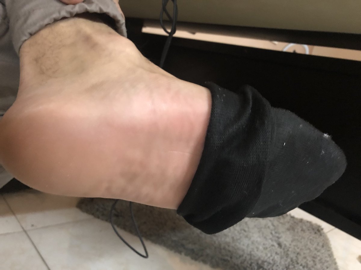 era0560's tweet photo. #feet #falaka #falaqa #feetfetish #الفلقة #الفلكة #المد_علي_الرجل https://t.co/7R9OylHMyB