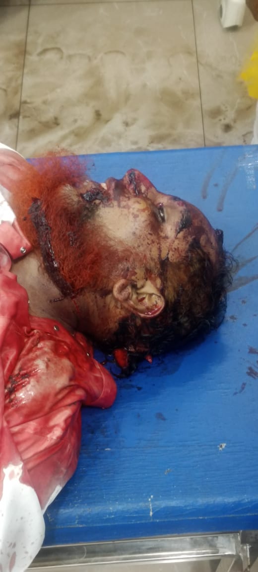 ISMAILBAIG78's tweet photo. Mysore : An incident occurred around 8:30 PM near Nimrah masjid where a Hafiz e Qur'an and member of SDPI was brutally murdered just because of politics @CPMysuru @Udayagiri2234 please arrest the culprits at the earliest.

#Police #Arrest https://t.co/8Jig8YuDMx