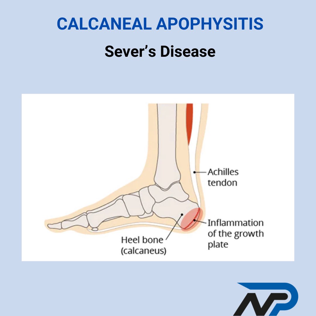 Nottingham Physio tweet media