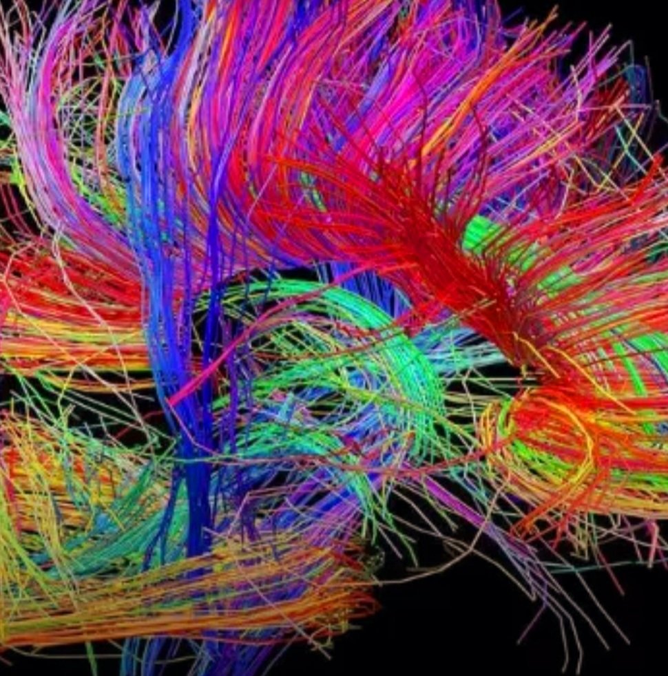 VictorOladokun's tweet photo. We are fearfully and wonderfully made.
Think about it. The human brain's cognitive capacity is powered by 100 billion neurons and a trillion glial cells.
#BrainCapacity
#NeuralNetwork
#Cognition
#Creativity https://t.co/qac2QfUS6J