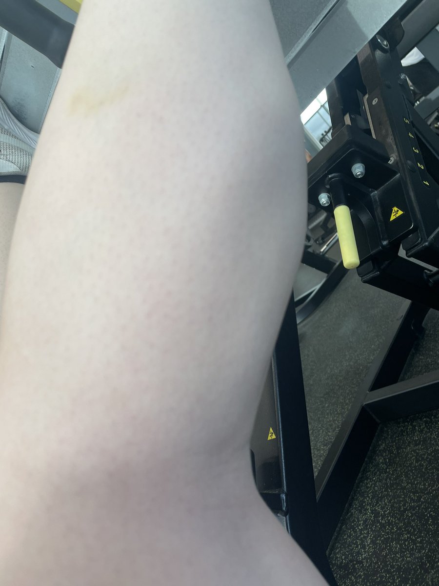 carreraa_fayeee's tweet photo. My calves are my prettiest muscle. They're truly my babies. But. I can lat pull 55KG now 😵‍💫🫣 https://t.co/W6JobCHgAq