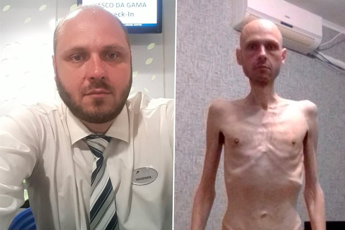 We have no moral right to forget about prisoners of war until every one of them is released and returns home. Volodymyr Tsema-Bursov lost in the russian captivity 38kg or 40% of his weight. Don't be silent! #freeazov #freeazovstaldefenders <a href="/ICRC/">ICRC</a> <a href="/UNHumanRights/">UN Human Rights</a>