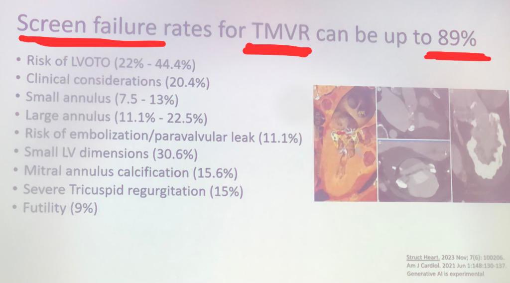 Presentation by @KendraGrubb today at #CRT2024 #CRT24 @CRT_meeting about #TMVR #TMVI - great option for patients with #MitralValve disease deemed high risk for surgery, but screen failure remains very HIGH👀 #StructuralHeart🫀 @tssmn @HeartValveOrg