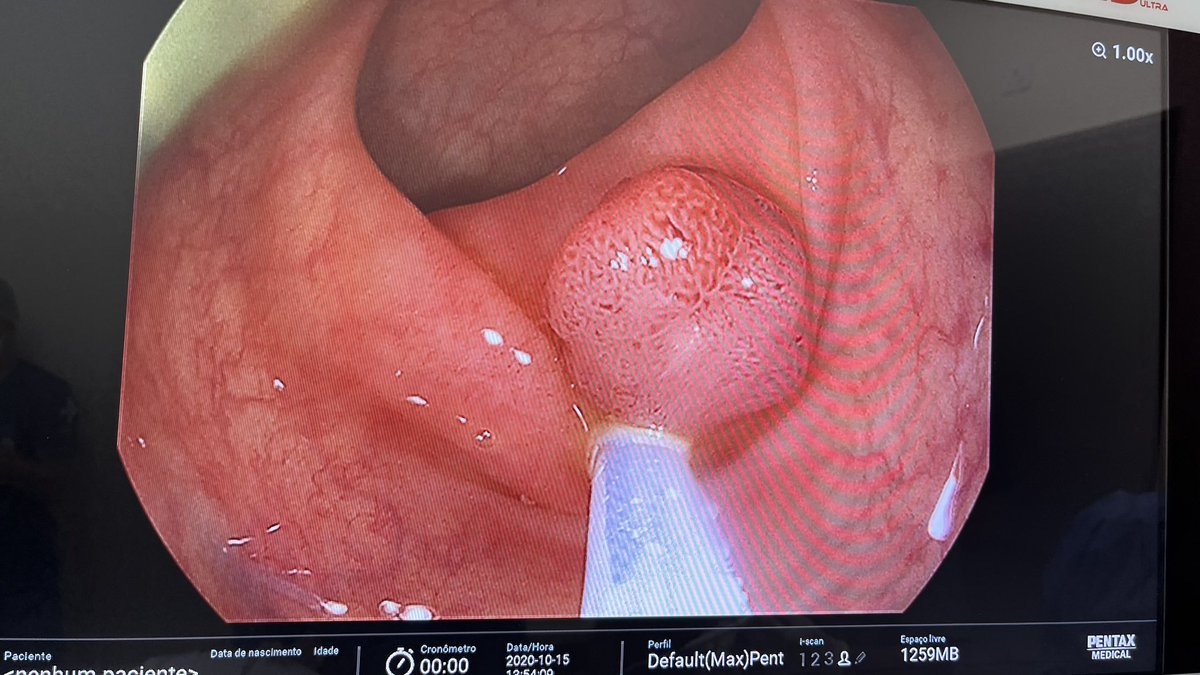 Lucia Oliveira,MD,PhD tweet media