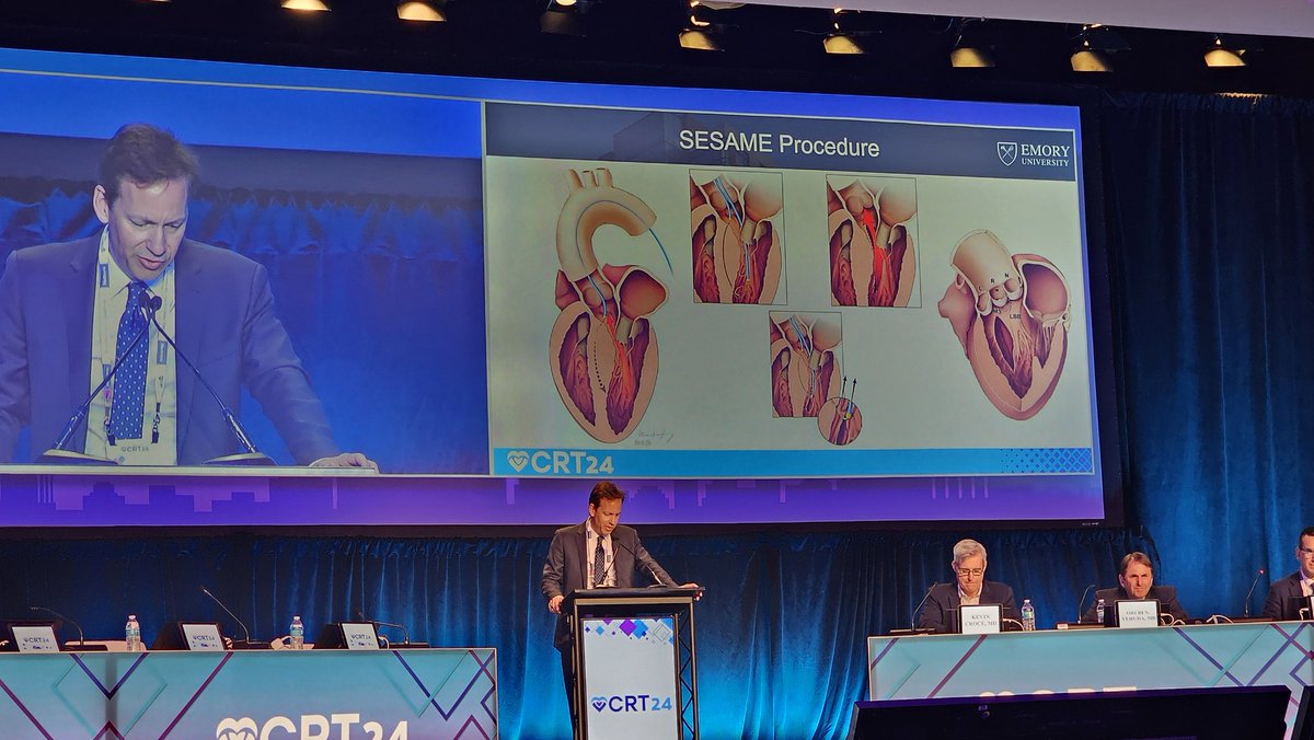 WallyOmarMD's tweet photo. SESAME for LVOT reduction demonstrates amazing ⬇️ in septal thickness and ⬆️ in neoLVOT area. #CRT2024 Late breakers. Great safety profile compared to traditional invasive alternatives. https://t.co/nIqAQkdWRz