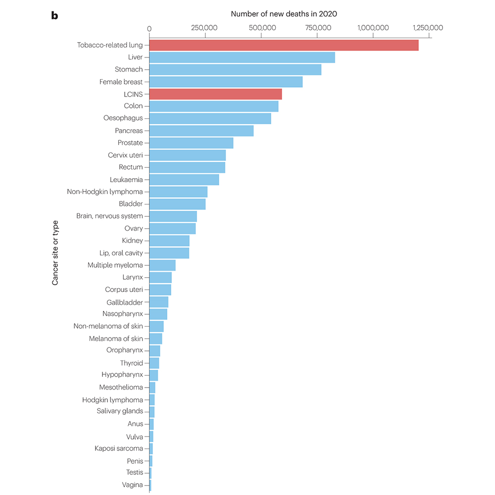 Nature Portfolio (@natureportfolio) on Twitter photo Lung cancer in individuals who have never smoked (LCINS) is estimated to be the fifth most common cause of cancer-related deaths globally. A Review in <a href="/NatRevClinOncol/">NatureRevClinOncol</a> reviews the emerging data regarding the causes and features of LCINS. 🔒 go.nature.com/3TcfOQO Lung cancer in individuals who have never smoked (LCINS) is estimated to be the fifth most common cause of cancer-related deaths globally. A Review in <a href="/NatRevClinOncol/">NatureRevClinOncol</a> reviews the emerging data regarding the causes and features of LCINS. 🔒 go.nature.com/3TcfOQO