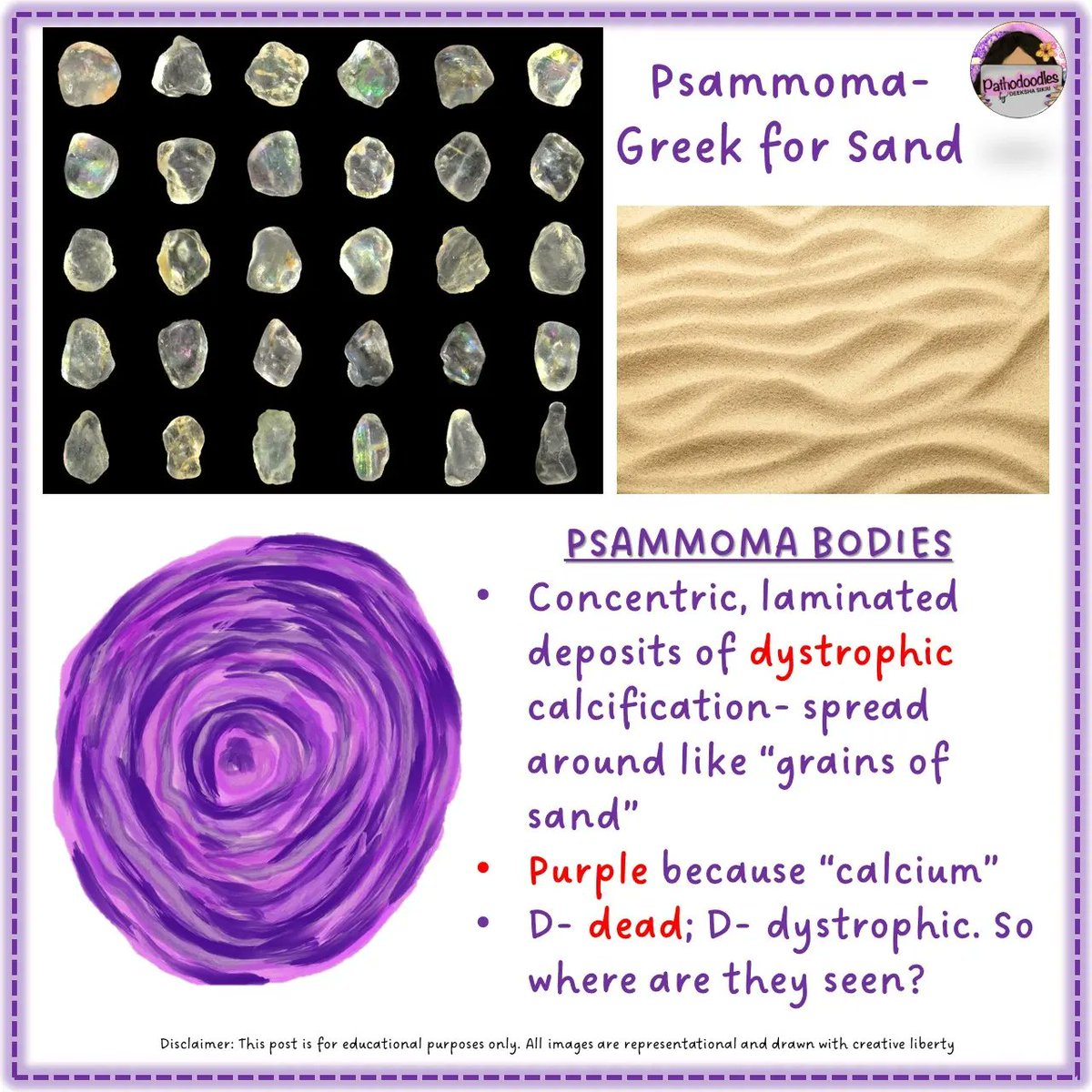 pathodoodles's tweet photo. #pathodoodles way to understand how and where of Psammoma bodies for #MedicalStudentTwitter #MedEd #PathTwitter #USMLE #NEET #inicet https://t.co/9H6LabgpfN
