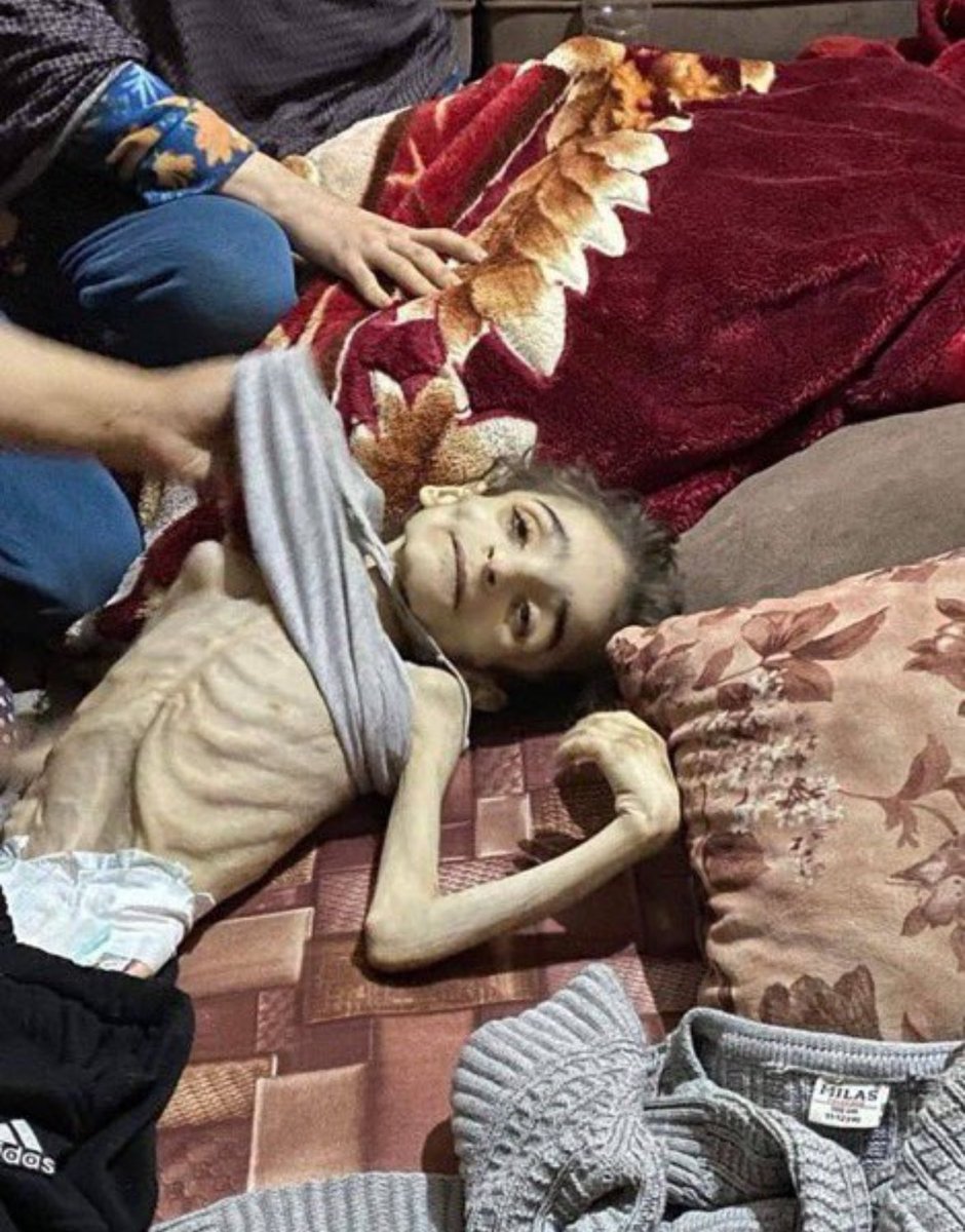 nowgnna's tweet photo. "تذكروا عند الصيام أن هناك أكثر من مليوني فلسطيني في غزة يموتون من القصف والجوع وتحولت أجسادهم إلى هياكل عظمية 🇵🇸✅ https://t.co/bRrYjT55UE