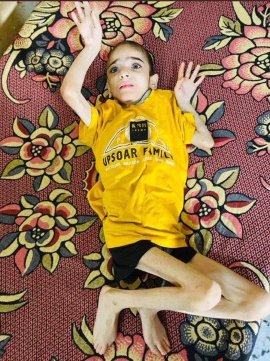 "تذكروا عند الصيام أن هناك أكثر من مليوني فلسطيني في غزة يموتون من القصف والجوع وتحولت أجسادهم إلى هياكل عظمية 🇵🇸✅