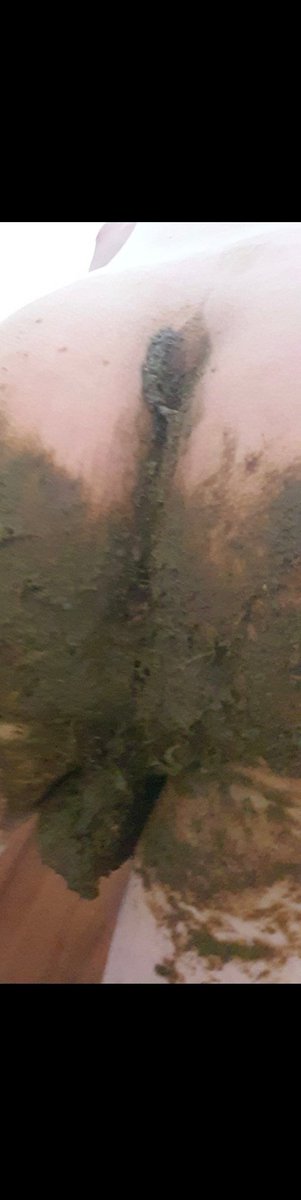 pantspooperguy's tweet photo. "Ewwwwww he DID pooped his pants!!" https://t.co/aQeX119b6l