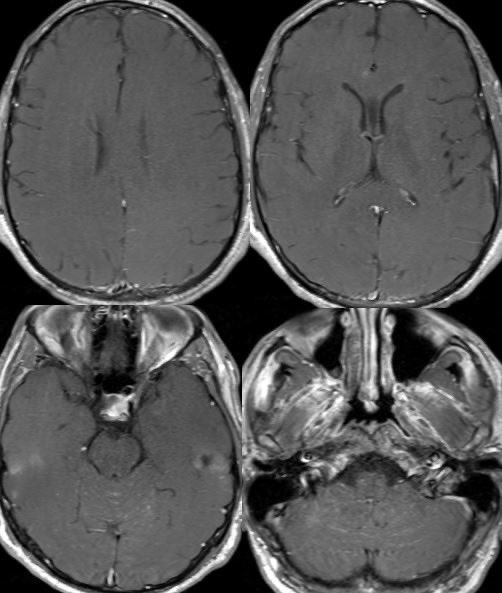 Daniel Gewolb, MD tweet media