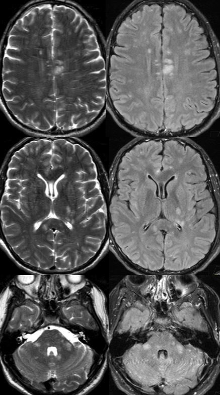 Daniel Gewolb, MD tweet media