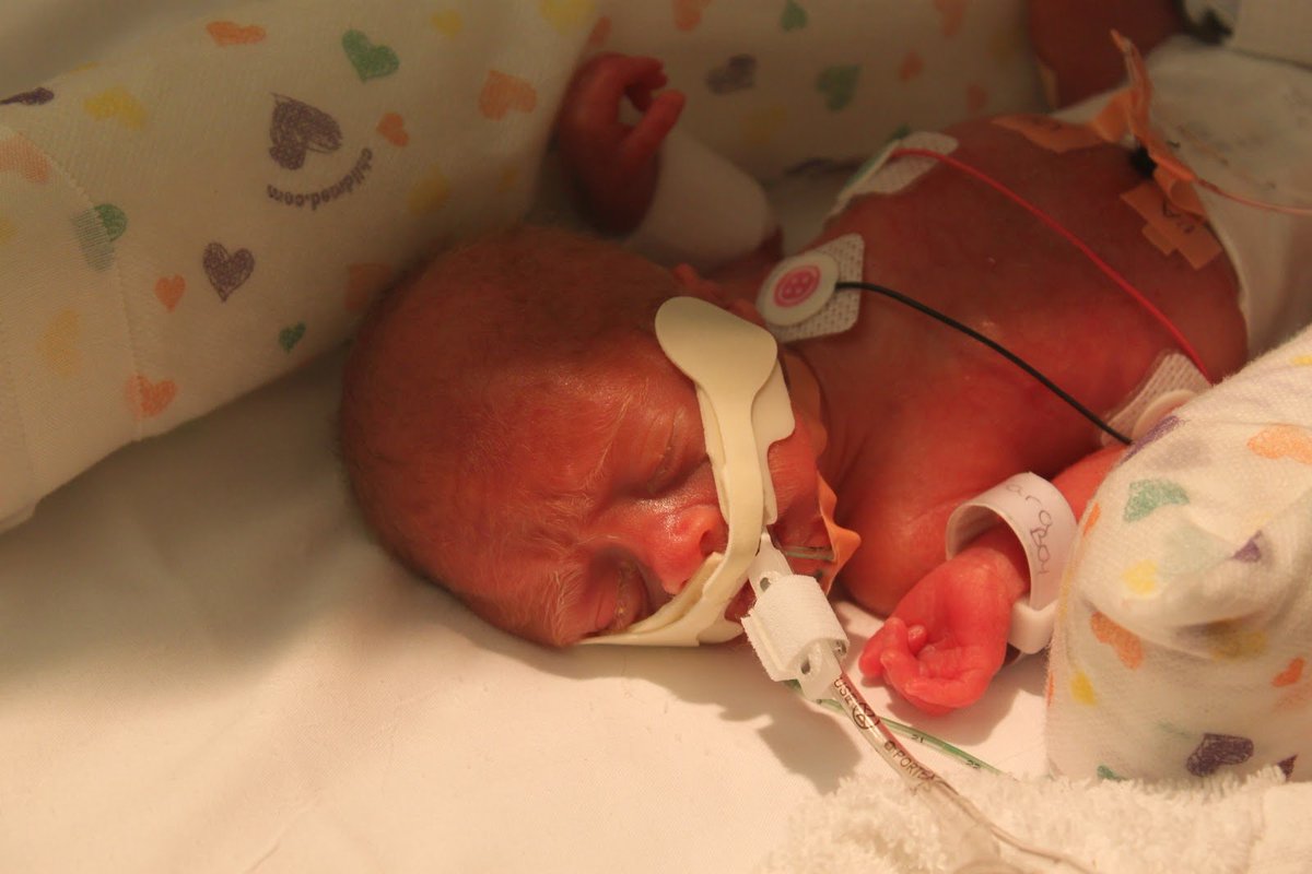 Quickest Curve tweet media