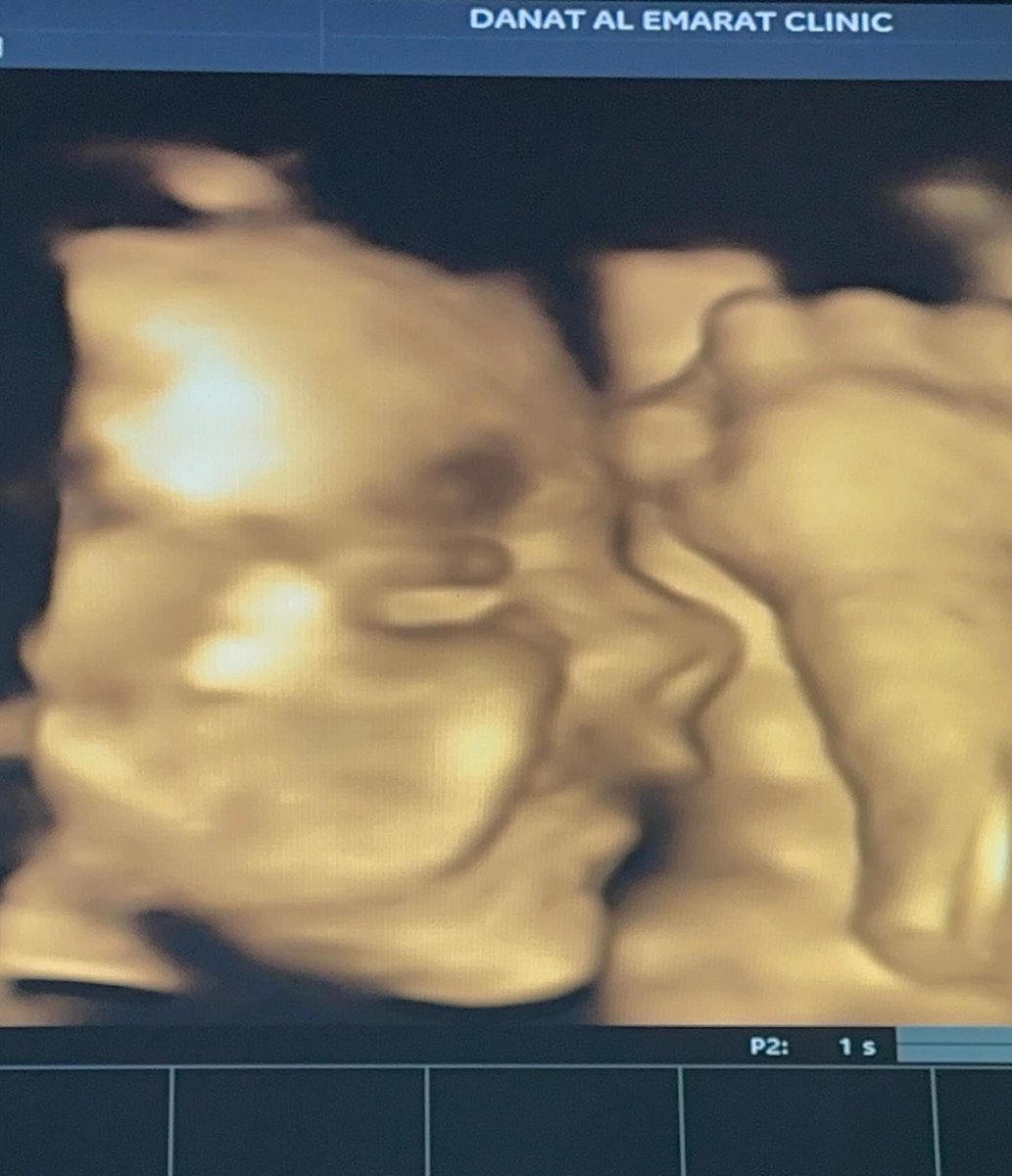 heeelize's tweet photo. Officially 2 days away from meeting our son 💙 https://t.co/xb2bPY5HRE