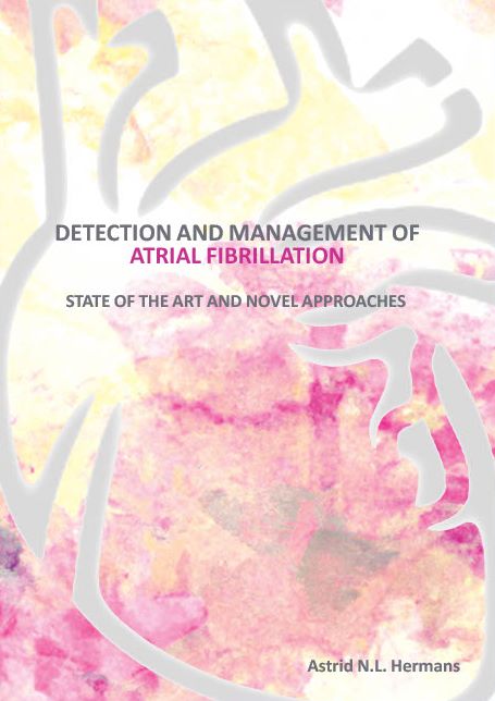 #thesisdefence Tomorrow, @AstridHermans will defend the thesis 'Detection and management of atrial fibrillation: state of art and novel approaches' at 16:00h @MaastrichtU 📺youtube.com/watch?v=ZF2sNh… 📖cris.maastrichtuniversity.nl/en/publication… #phdlife @Dominik_Linz @kvernooy @UliSchotten