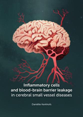 #thesisdefence Tomorrow, Daniëlle Kerkhofs will defend the thesis 'Inflammatory cells and blood-brain barrier leakage in cerebral small vessel diseases' at 10:00h @MaastrichtU 📺youtube.com/live/UtTUnbsQO… #phdlife @S_Foulquier