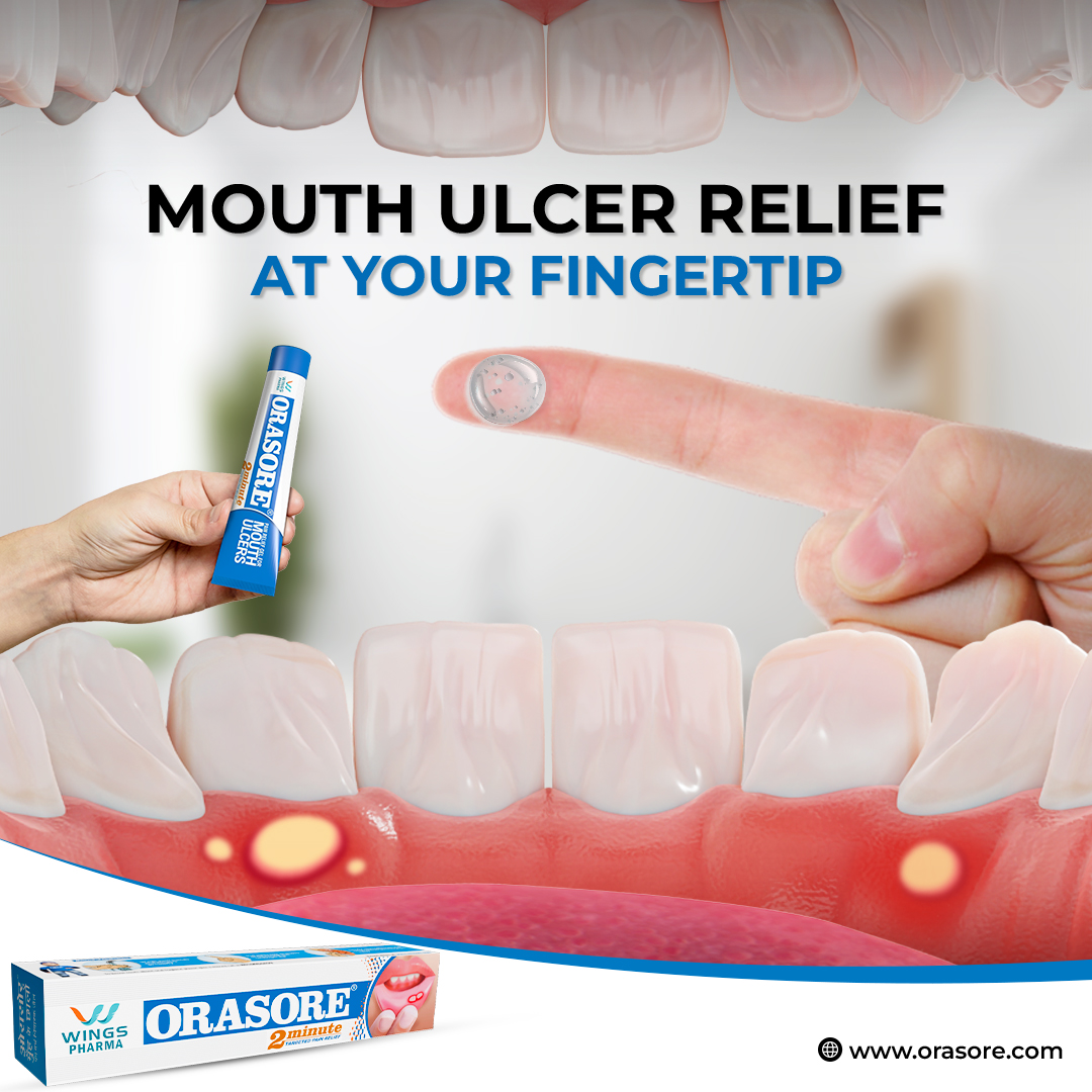 Discover fast-acting relief from the discomfort of mouth ulcers with #OrasoreMouthUlcerGel With its powerful anaesthetic and anti-inflammatory properties, it swiftly alleviates pain, providing you with comfort in just 2 minutes.

#instantrelief #mouthulcerrelief #MouthUlcers