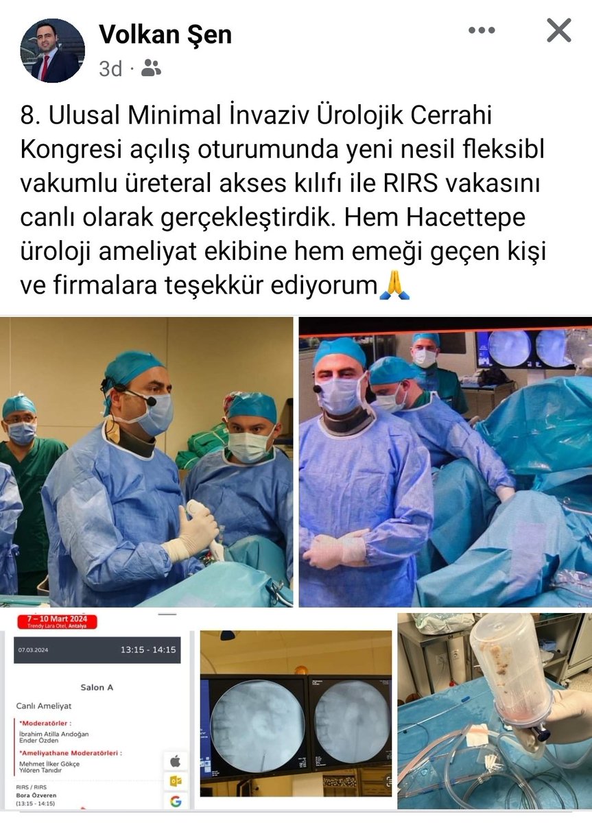 8th National Minimal Invasive Urologic Surgery Congress, @MIUD_DERNEGI

Live RIRS Surgery performed by Assoc. Prof. Dr. Volkan ŞEN @drvolkansen by using #ClearPetra (@JustineShi_js) Urethral Access Sheath with suction and deflectable tip and #HugeMed 7.5Fr Digital Single-Use URS