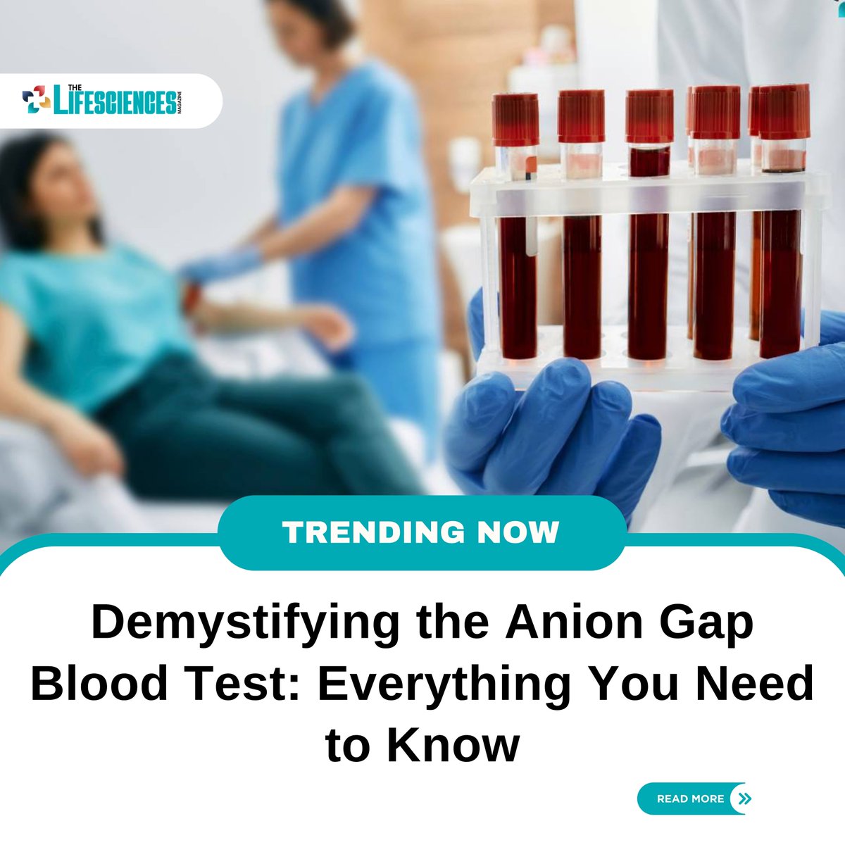 lifesciencesmag's tweet image. Anion Gap Blood Test: Everything You Need to Know 

The Anion Gap Blood Test measures the difference between the concentrations of positively charged ions (cations) and negatively charged ions (#anions) in the blood serum

Know More: thelifesciencesmagazine.com/understanding-…

#AnionGap #BloodTest
