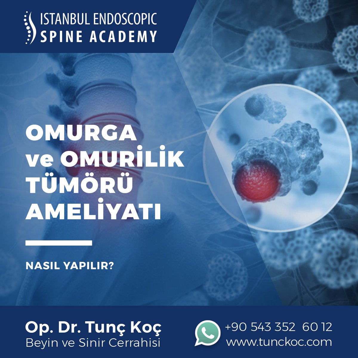 TuncKoc's tweet photo. Bu konuda daha ayrıntılı bilgiyi https://t.co/hxOsmnsO8T web sitemizdeki “Omurga Hastalıkları” bölümünde bulabilirsiniz.

Danışma ve randevu için:
+90 543 352 60 12

#omurgatümörü #omuriliktümörü #omurgacerrahisi #omurgaameliyatları #omurilikameliyatları #drtunçkoç https://t.co/kmbUK7qDRS