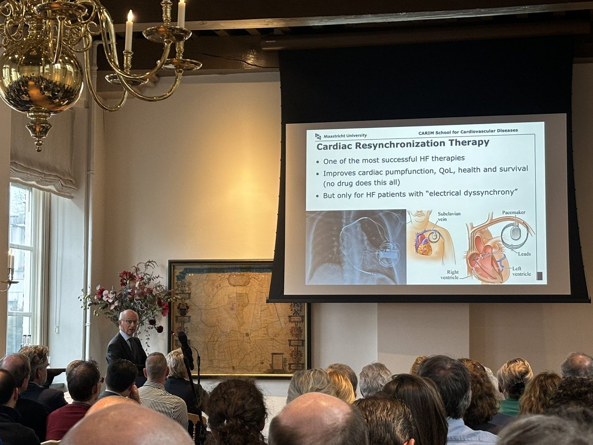 Professor Prinzen explains CRT at the “40 yrs ICD therapy symposium”. he started his explanation with “for those who have been living under a stone for the last 20 years, CRT…. 😂 @MaastrichtUMC @CARIMMaastricht @KnopsReinoud @Dominik_Linz @SCYap77 @JLuermans