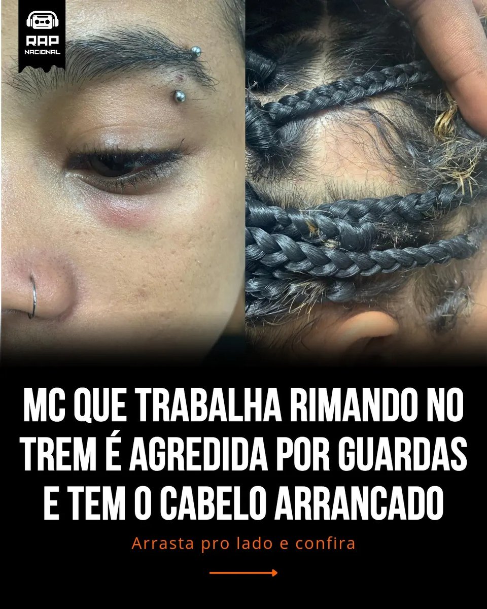 luthithome's tweet photo. #Repost @rapnacionalofficial
Absurdo! 🤬
Na noite deste domingo, a MC @kisha.zo , que trabalha rimando no trem, foi agredida por guardas da CPTM e teve seu cabelo arrancado, a ação covarde e racista foi gravada em live por suas amigas.
Kisha disse que foi na delegacia relatar o https://t.co/q7xpZDyBuX
